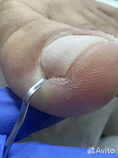 Подолог / маникюр / педикюр