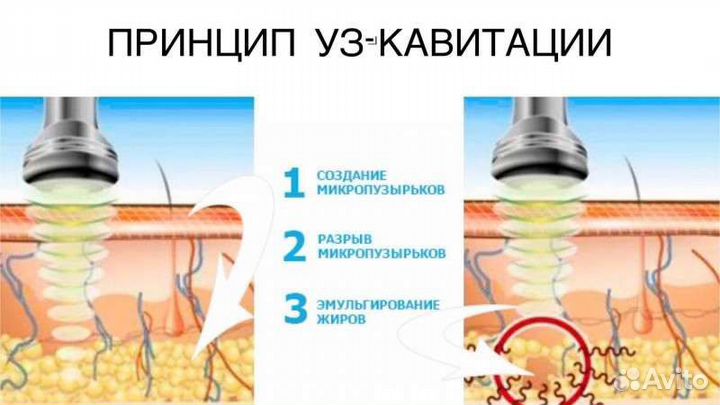 Аппаратный массаж тела