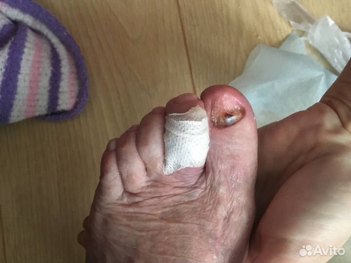 Подолог. Педикюр