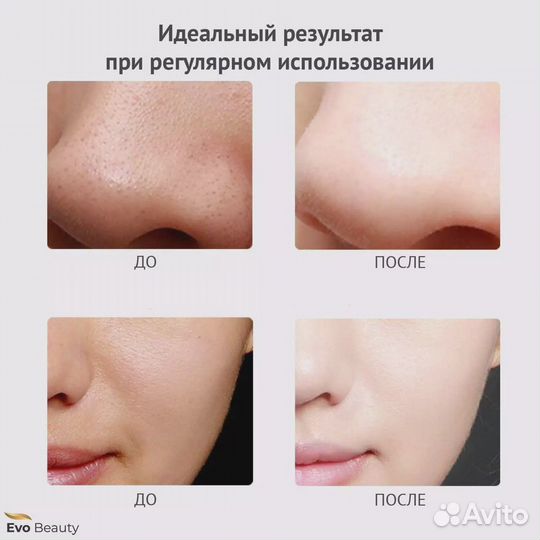 Аппарат для ультразвуковой чистки лица Evo Beauty