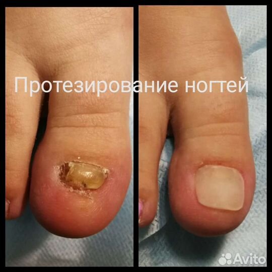 Подолог опытный