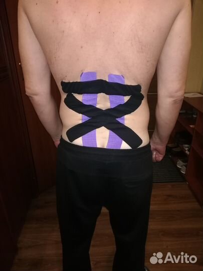 Эстетическое тейпирование лица и тела