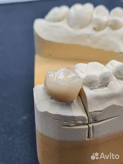 Литьё Emax press