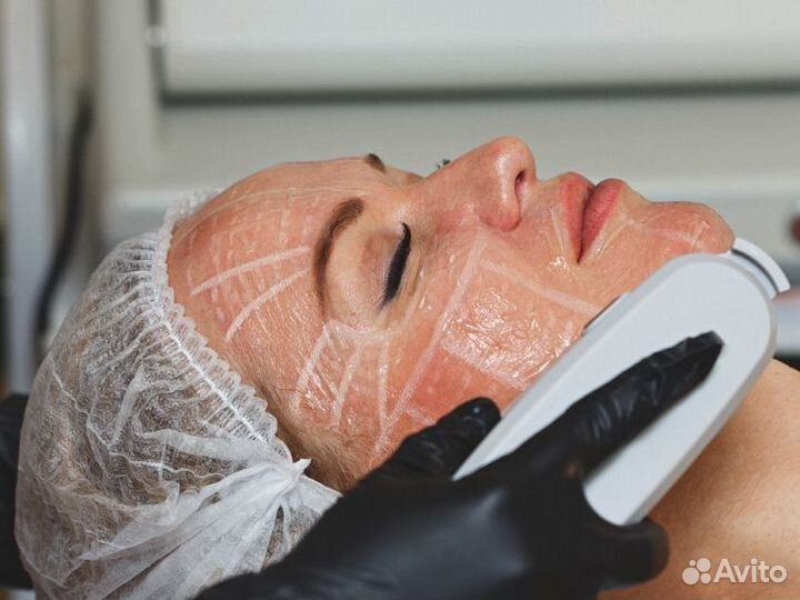 СМАС лифтинг