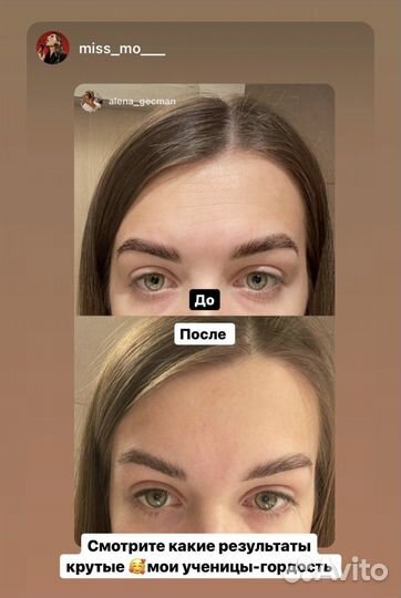 Классический массаж