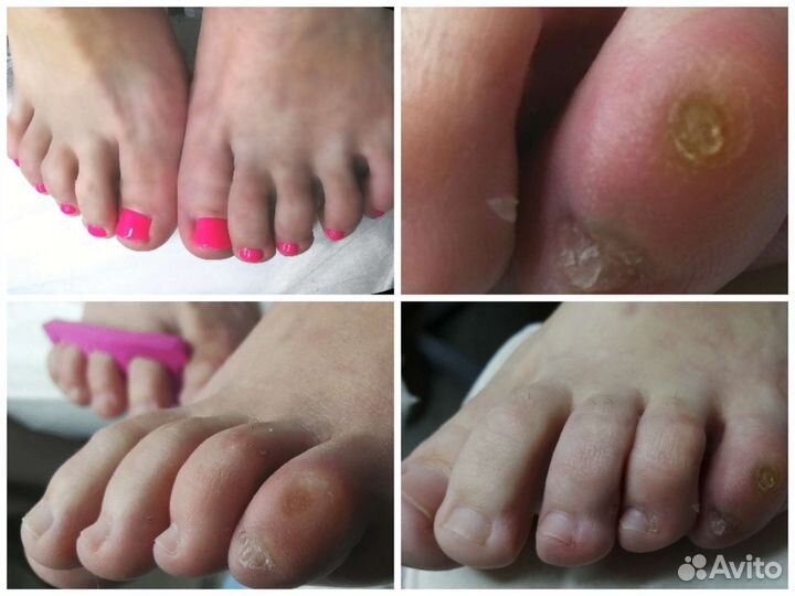 Маникюр педикюр