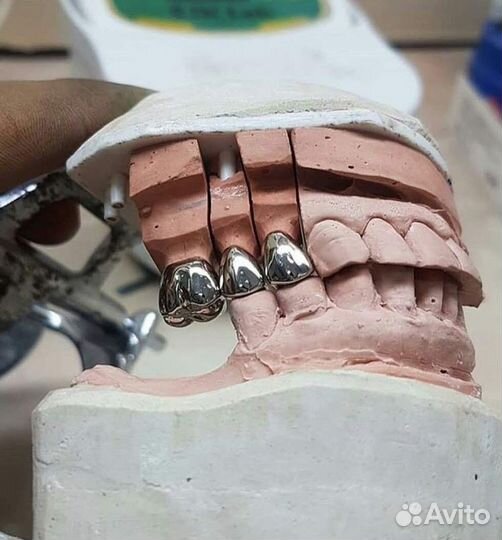 Зубной техник