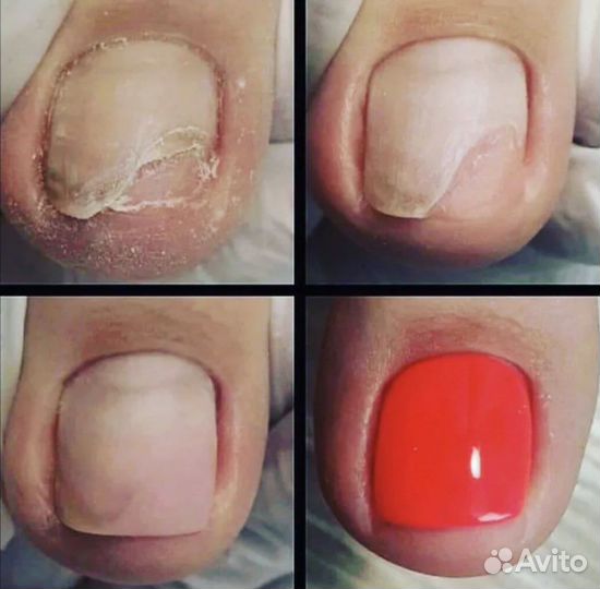 Маникюр гель лак наращивание педикюр