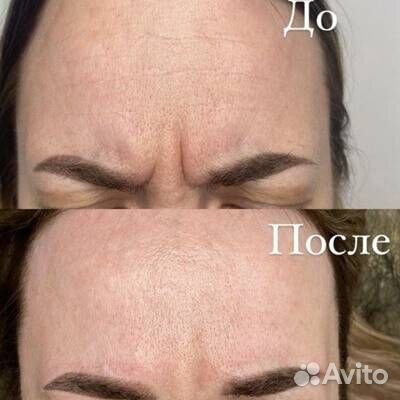 Услуги косметолога