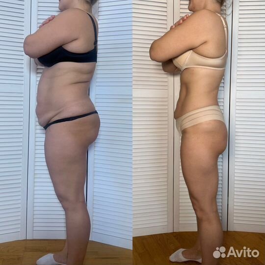 Антицеллюлитный массаж,Коррекция фигуры