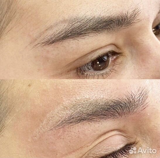 Удаление тату и татуажа