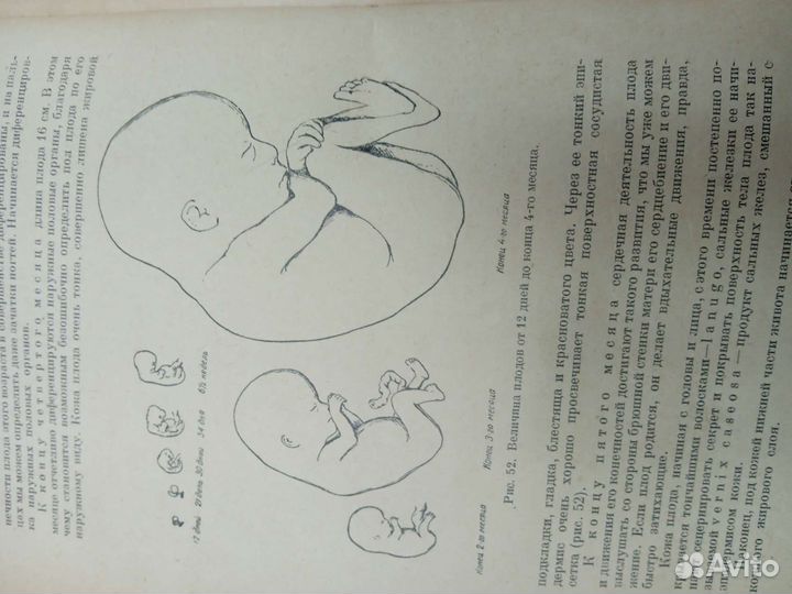 Учебник акушерства 1937г