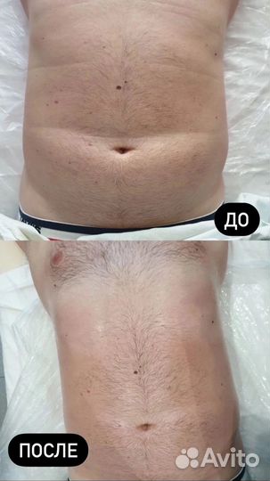 Массаж на дому