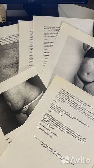 Аппаратный и ручной массаж