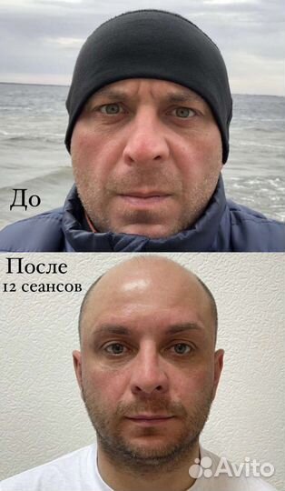 Ручной массаж лица и тела