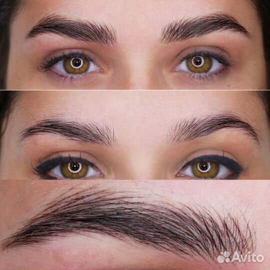 Гиперестественные брови Аппаратные волоски