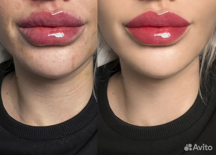 Ретушер и обработка фотографий, ретушь фото