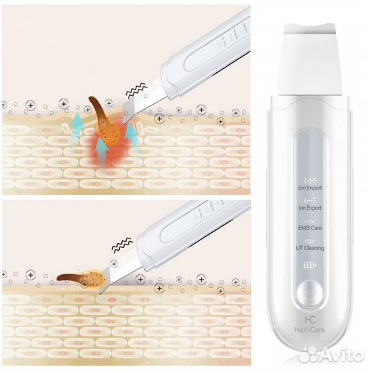 Ультразвуковой очиститель для лица