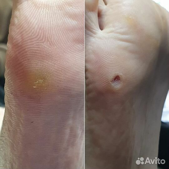 Подолог с медицинским образованием