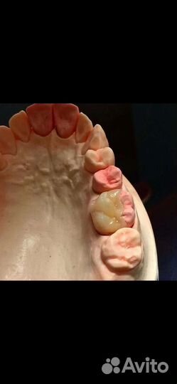 Зубной техник-керамист