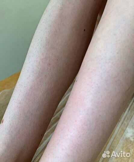 Шугаринг метро Беговая