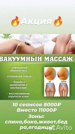 Антицеллюлитный, фитобочка, аппаратный