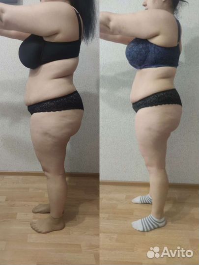 Антицеллюлитный массаж, лимфодренажный массаж