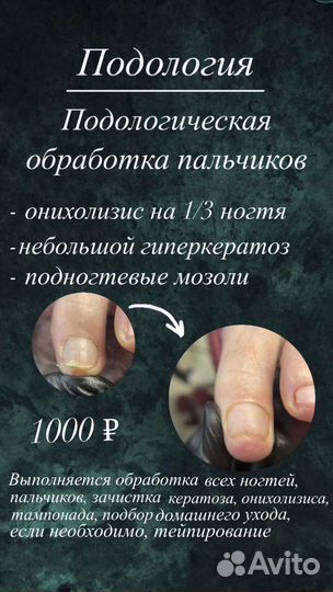 Подолог: педикюр, онихолизис, грибок, kart