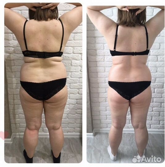 Мастер антицеллюлитного массажа