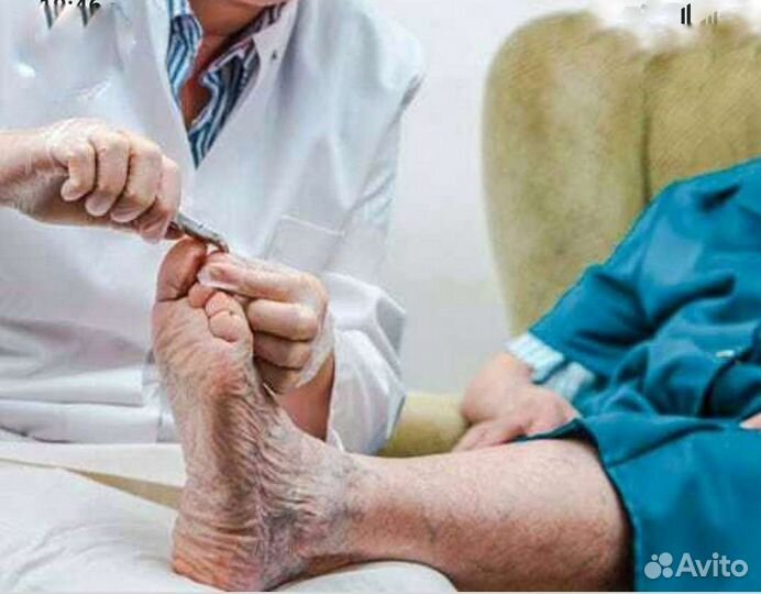 Педикюр.Выезд на дом к пожилым людям