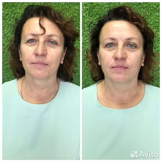 Массаж лица