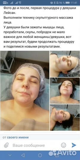 Профессиональный Массаж в Лазаревском