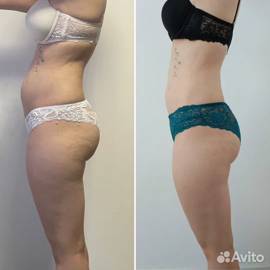 Коррекция фигуры