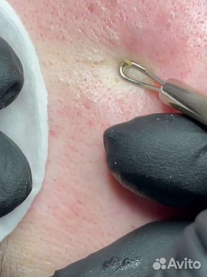 Депиляция,буккальный массаж лиц,чистка лица,брови