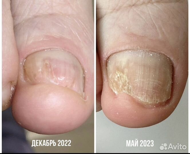 Педикюр подолог центр