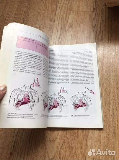 Медицинская книга семиотика