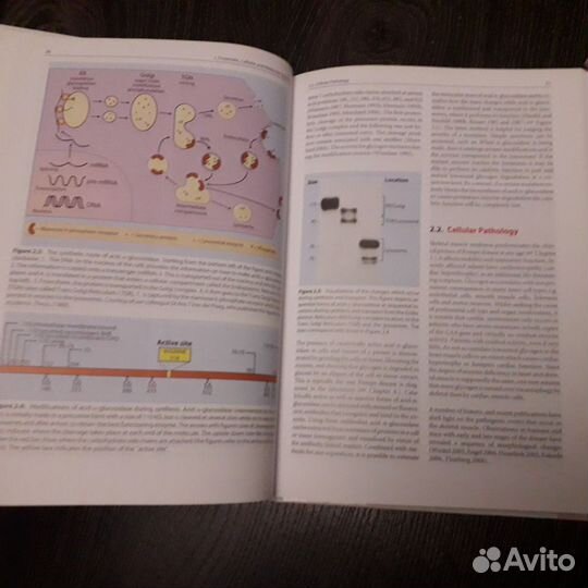 Болезнь Помпе. M. Baethmann. Pompe Disease