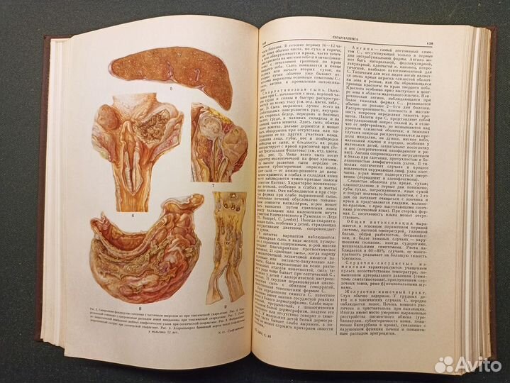 Большая медицинская энциклопедия. Том 30. 1963 