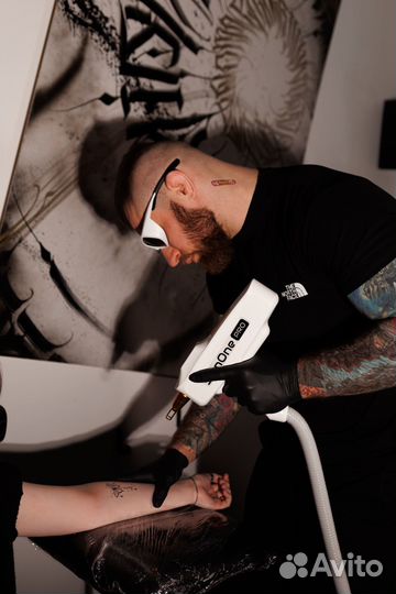Лазерное удаление татуировок