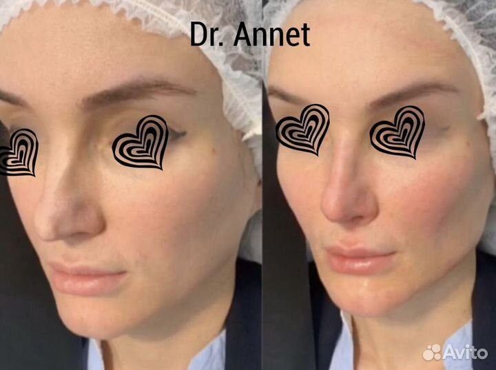 Врач косметолог