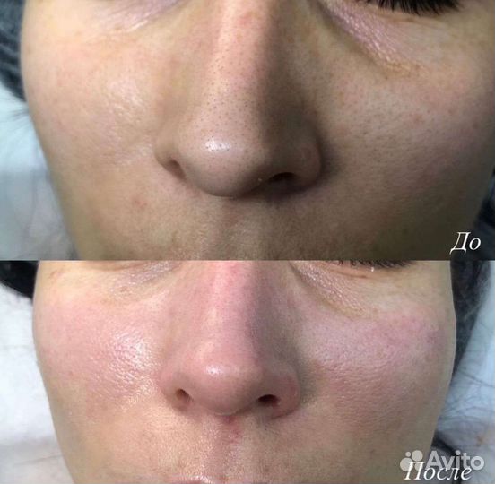 Услуги косметолога