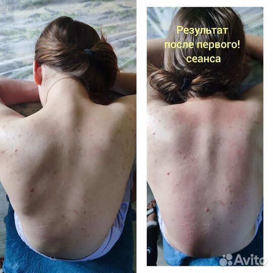 Профессиональный лечебный массаж, аппаратный