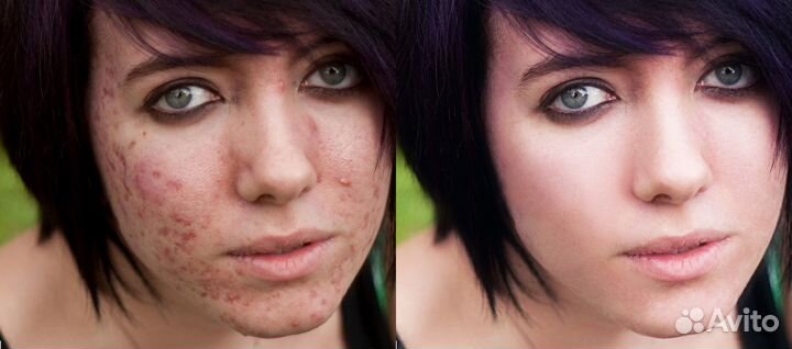 Ретушь фото