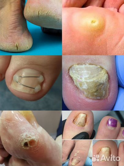 Ищу модель. Подолог