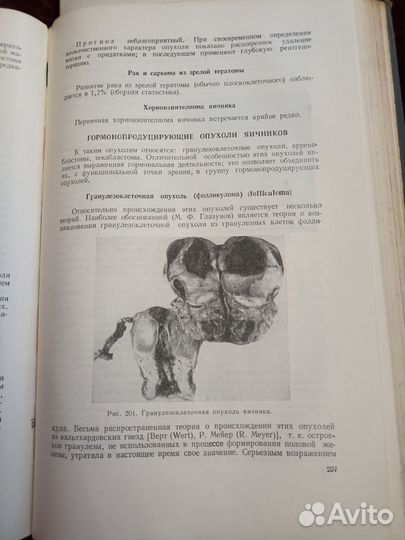Гинекология