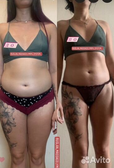 Массаж на дому