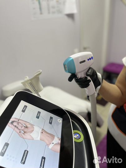 Готовый бизнес лазерной эпиляции