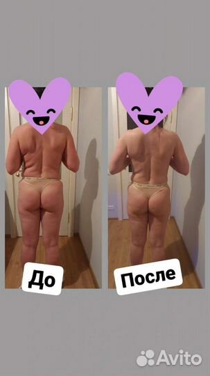 Lpg массаж/вибромассаж/кавитация