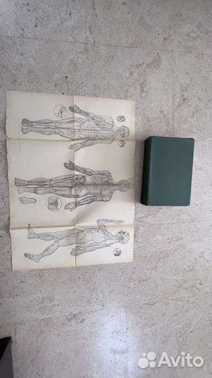 Иглоукалывание