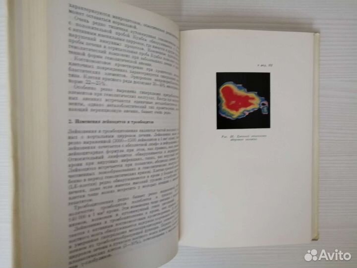 Клиническая гепатология (1970г.) / З. Бондарь